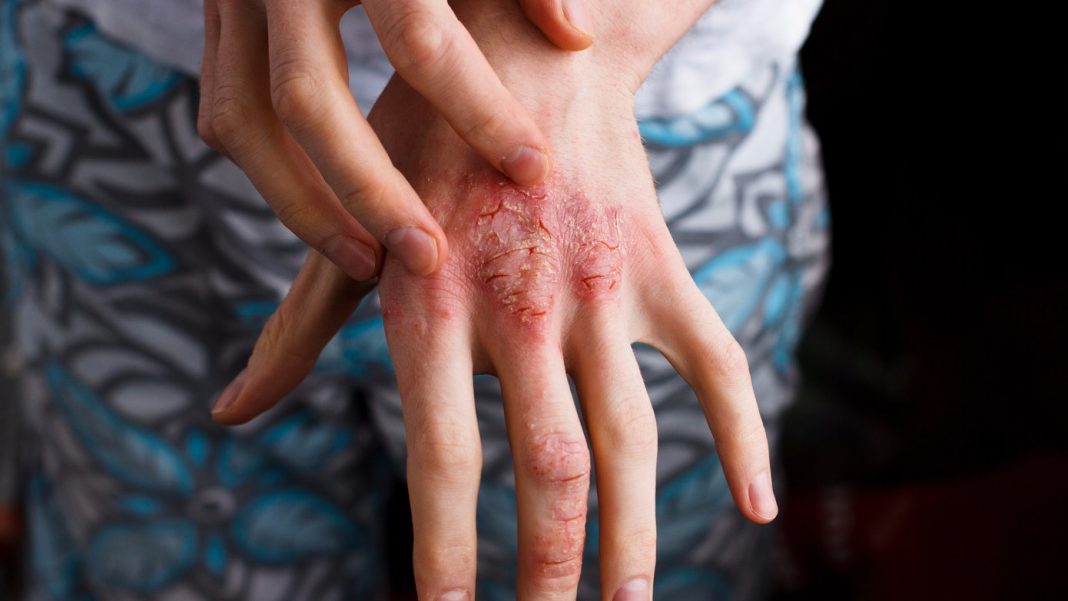 Top 10 Most Common Skin Issues Among Men and Women